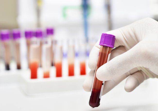 Bluttest Metabolic Balance Bluttest Metabolic Balance
