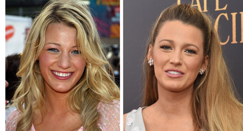 Blake Lively vorher nachher