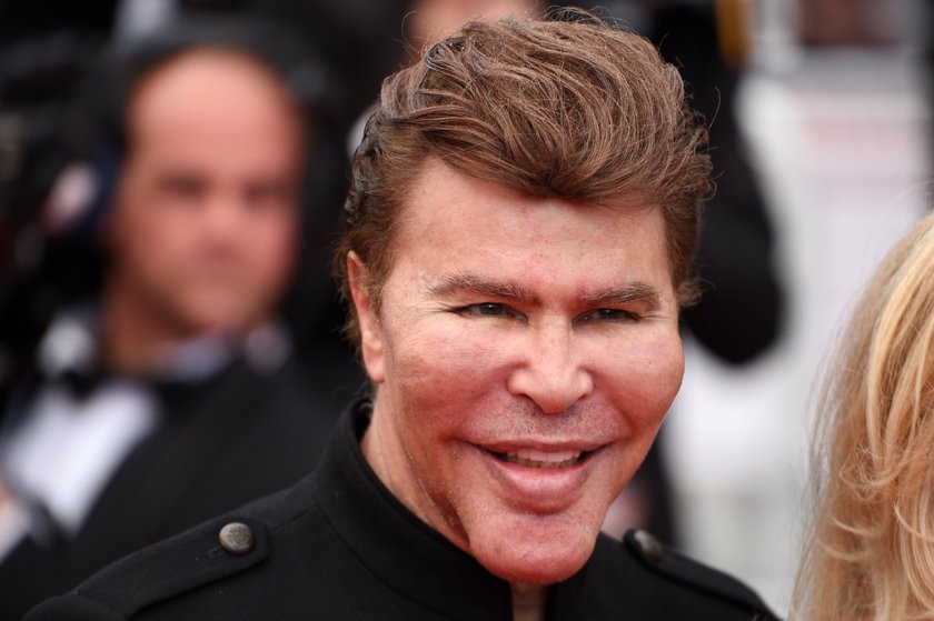 Botox-Zwilling Grichka Bogdanoff